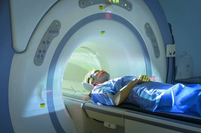 tips on getting mri approval by insurance